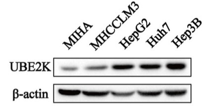 UBE2K protein expression in HCC and MIHA cells.jpg